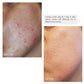 Blemish Correct Soothing Serum & Spot Treatment